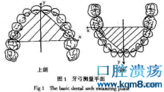 牙齿矫正时医生说的扩弓、支抗钉、片切究竟是什么意思？