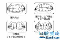 对图自测，你的牙齿是否真的需要矫正吗？