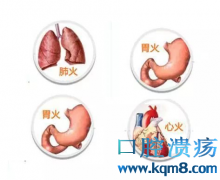 口腔溃疡、咽喉肿痛怎么办？？？