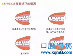 小孩子口腔正畸治疗的最佳时机是什么时候？