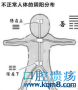 口腔溃疡、舌疮、慢性咽炎、失眠、体寒很有可能是上热下寒虚火原因