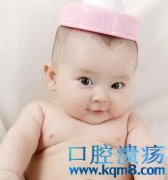 哺乳期口腔溃疡的药物治疗