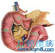 十二指肠溃疡并发症——幽门梗阻、出血、穿孔、癌变...