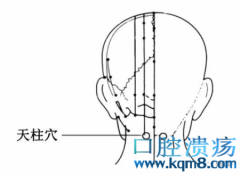 天柱穴的准确位置图功效与作用：通经活络、有效调理肾气，治疗腰肌劳损