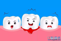 牙周炎症状表现及用药治疗方法