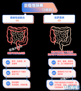 炎症性肠病无法治愈、伴随终生，怎么吃特别关键！