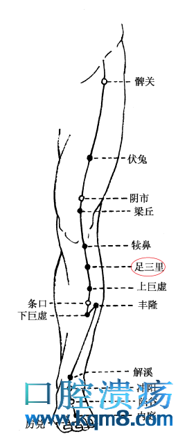 治疗口腔溃疡，中医有妙法